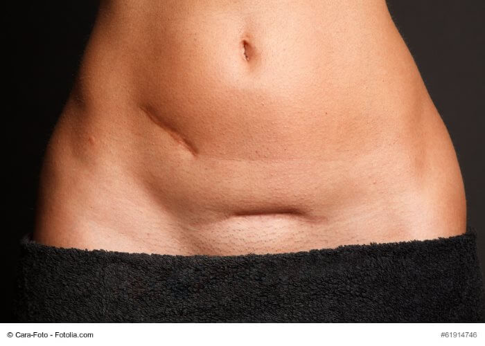 © Cara-Foto - Fotolia.com