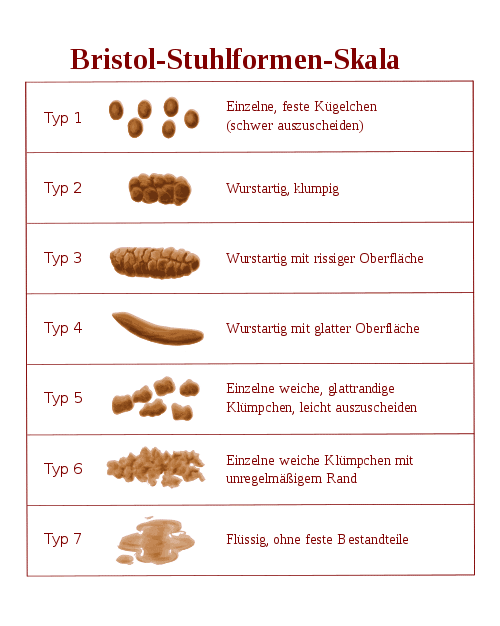 Eine Übersicht der Bristol-Stuhlformen-Skala