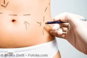 © Benko Zsolt – Fotolia.com