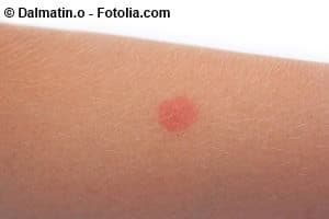 © Dalmatin.o - Fotolia.com