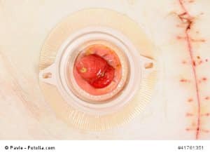 © Pavle - Fotolia.com