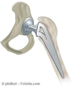 © philhol – Fotolia.com