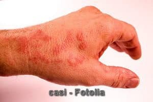 © casi - Fotolia.com