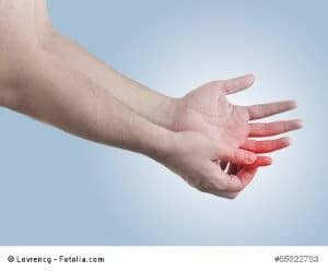 © Lovrencg - Fotolia.com