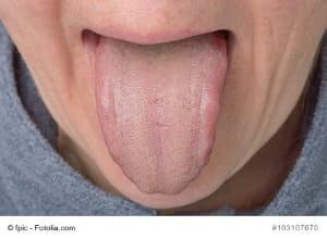 Geschwollene Zunge Allergie