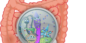 Durchfall – Ursachen und Gegenmittel