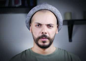 Welche Alternativen gibt es zur Haartransplantation?