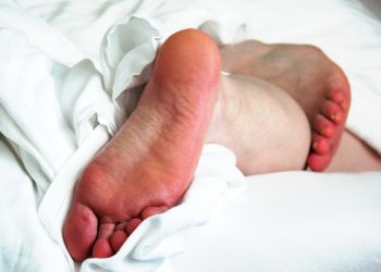 Hornhaut entfernen – Tipps zur schonenden Entfernung