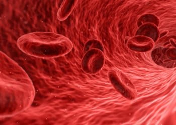 Arterie