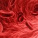 Blutvergiftung erkennen – auffällige Anzeichen einer Sepsis?