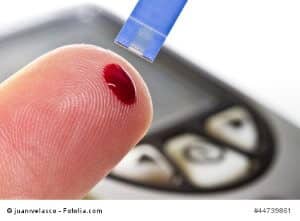 © juanrvelasco - Fotolia.com