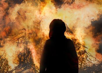 Was tun bei Verbrennungen?