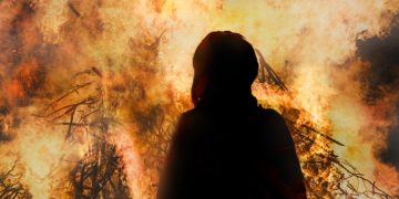 Was tun bei Verbrennungen?