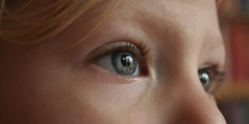 Stirnlifting: Ablauf, Kosten und Risiken des offenen und endoskopischen Stirnliftings