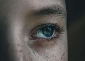 Trockene Augen: Vitaminmangel und andere Ursachen