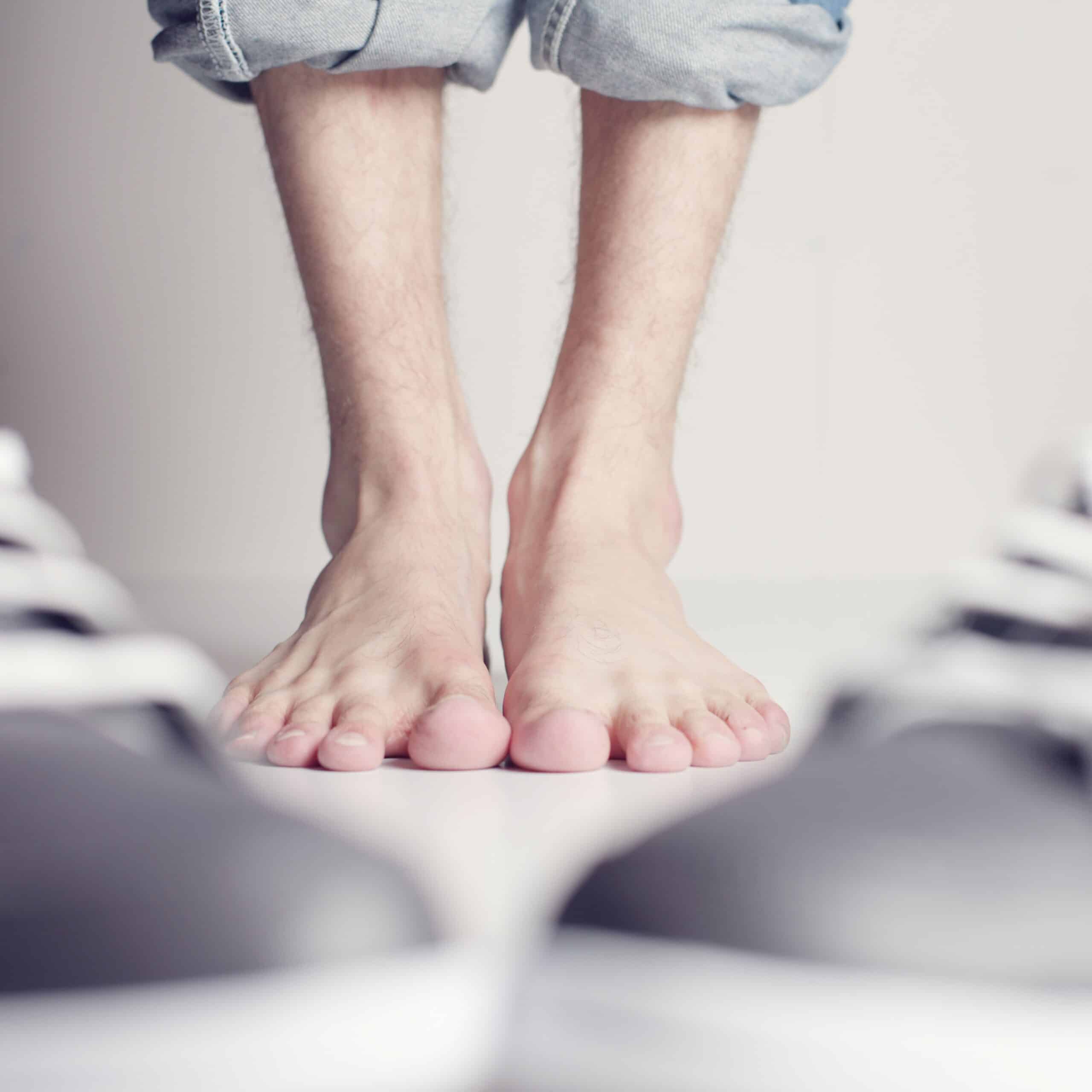 Zehen mit Fußpilz-Erkrankung
