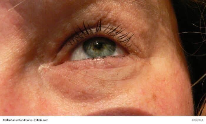 Fremdkörper Im Auge Nicht Sichtbar www.gesundheits-fakten.de