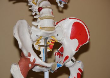 Künstliches Hüftgelenk – Komplikationen einer Hüftprothese