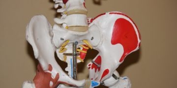 Künstliches Hüftgelenk – Komplikationen einer Hüftprothese