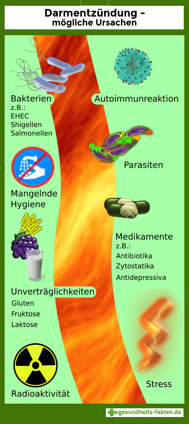 Infografik zu Ursachen einer Dickdarmentzündung