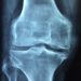 Leben mit Rheuma: Alltagstipps, die Rheumapatienten das Leben erleichtern