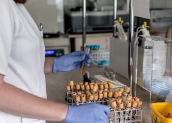 Welche Vorteile bieten Ultra-Tiefkühlschränke für Labore?