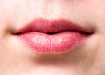 Trockener Mund (Mundtrockenheit) – Ursachen und Gegenmittel