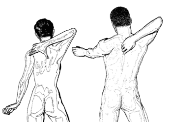 Hexenschuss: Übungen, Behandlung und Medikamente