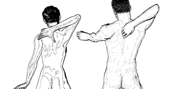 Hexenschuss: Übungen, Behandlung und Medikamente