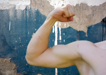 Informationen zur Oberarmstraffung: Kosten, Risiken und Ablauf des Eingriffs