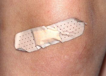 Knacken im Knie – mögliche Ursachen und Therapien