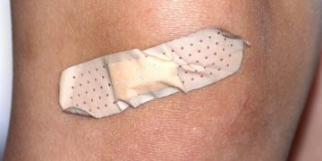 Knacken im Knie – mögliche Ursachen und Therapien