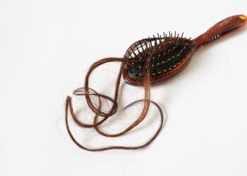 Die psychischen Belastungen bei Haarausfall und die Lösungen