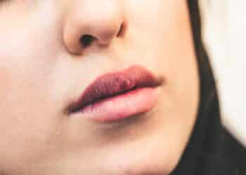 Trockenheit und Brennen im Mund – gibt es eine Lösung?