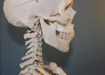 Cranio Mandibuläre Dysfunktion: Wenn Kiefer und Schädel nicht zusammenarbeiten