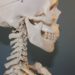 Cranio Mandibuläre Dysfunktion: Wenn Kiefer und Schädel nicht zusammenarbeiten