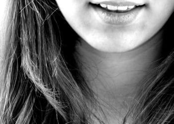 Eingerissene Mundwinkel – Ursachen und Therapieoptionen