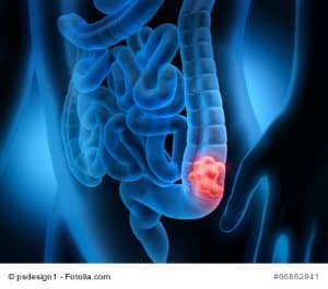 © psdesign1 - Fotolia.com