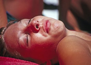 Was tun gegen Sonnenbrand – Akuthilfe und Hausmittel