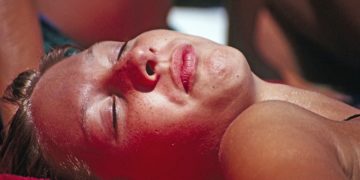 Was tun gegen Sonnenbrand – Akuthilfe und Hausmittel