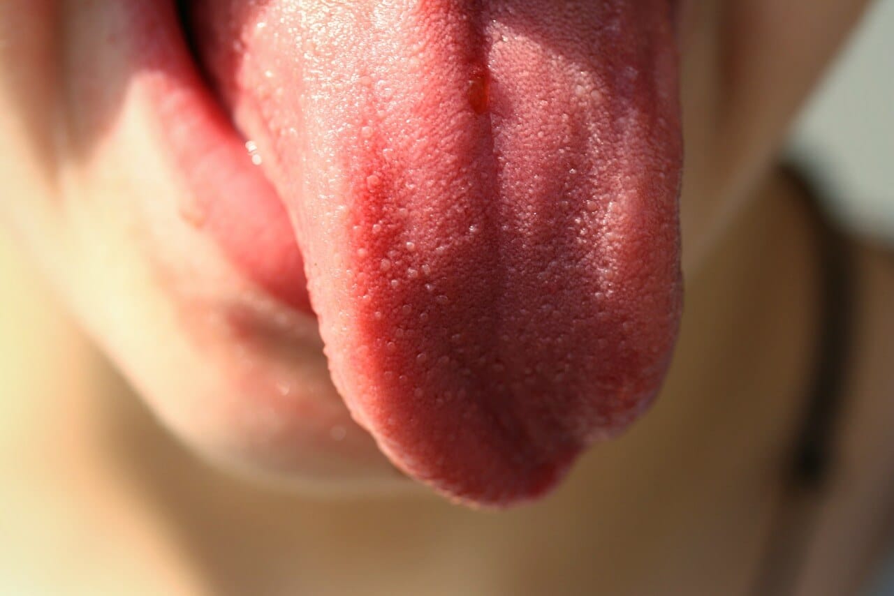 Zungenpiercing entzündung unter der zunge